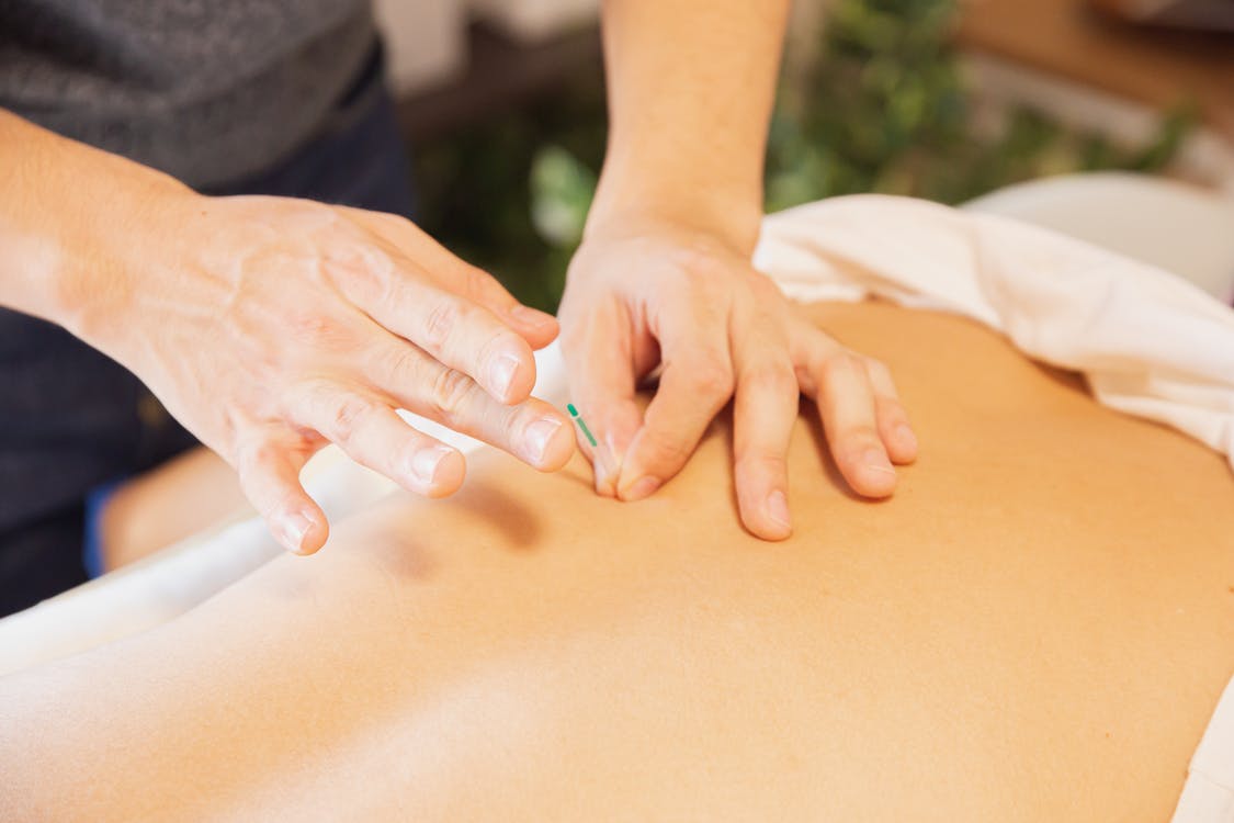 The Benefits of Combining Acupuncture with Physical Therapy