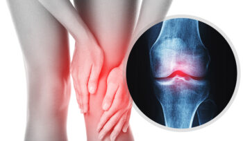 Osteoarthritis and joint pain - Boost Physiotherapy